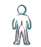 Sciatica
